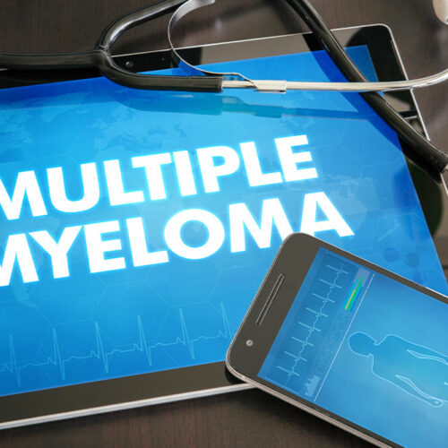 Understanding multiple myeloma, its early signs, and symptoms